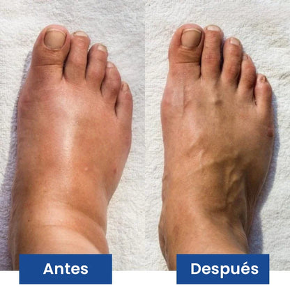 NUEVO Masajeador de Pies PROFESIONAL® - Con Tecnología EMS