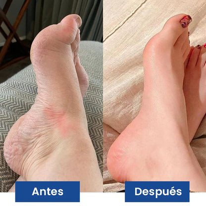 NUEVO Masajeador de Pies PROFESIONAL® - Con Tecnología EMS
