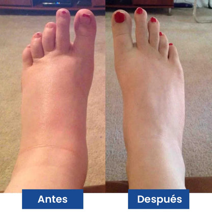 NUEVO Masajeador de Pies PROFESIONAL® - Con Tecnología EMS